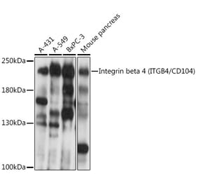 Western Blot - Anti-Integrin beta 4 Antibody (A308080) - Antibodies.com