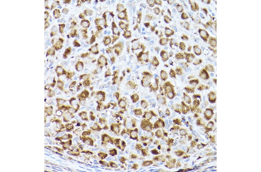 Immunohistochemistry - Anti-Acetyl Coenzyme A carboxylase alpha Antibody (A308082) - Antibodies.com
