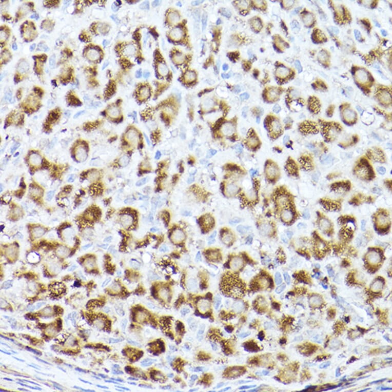 Immunohistochemistry - Anti-Acetyl Coenzyme A carboxylase alpha Antibody (A308082) - Antibodies.com