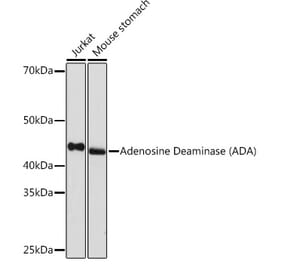 Western Blot - Anti-ADA Antibody [ARC1152] (A308084) - Antibodies.com