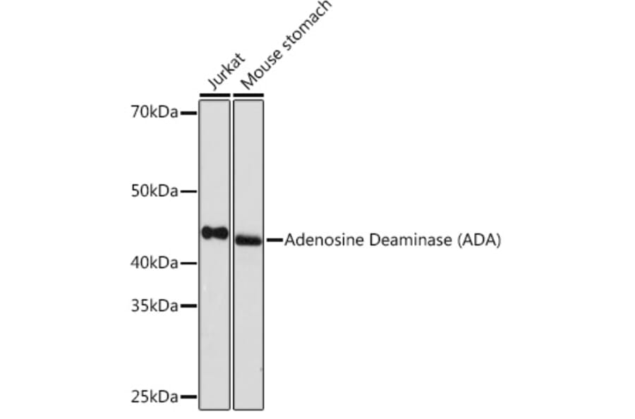 Western Blot - Anti-ADA Antibody [ARC1152] (A308084) - Antibodies.com