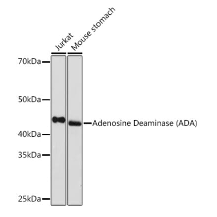 Western Blot - Anti-ADA Antibody [ARC1152] (A308084) - Antibodies.com