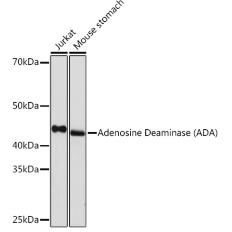 Western Blot - Anti-ADA Antibody [ARC1152] (A308084) - Antibodies.com