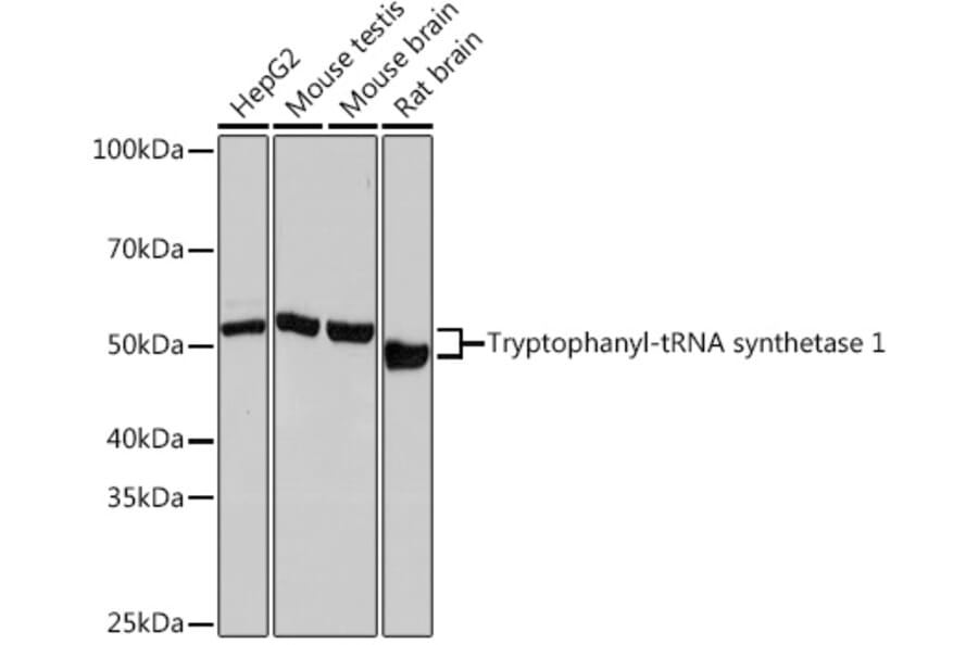 Western Blot - Anti-Tryptophanyl tRNA synthetase/WRS Antibody [ARC1018] (A308088) - Antibodies.com