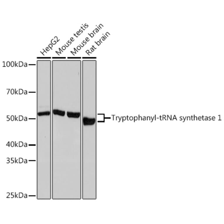 Western Blot - Anti-Tryptophanyl tRNA synthetase/WRS Antibody [ARC1018] (A308088) - Antibodies.com