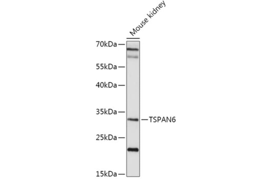 Western Blot - Anti-TSPAN6 Antibody (A308089) - Antibodies.com