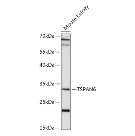 Western Blot - Anti-TSPAN6 Antibody (A308089) - Antibodies.com