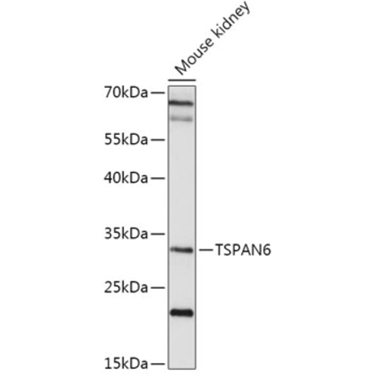 Western Blot - Anti-TSPAN6 Antibody (A308089) - Antibodies.com