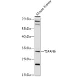 Western Blot - Anti-TSPAN6 Antibody (A308089) - Antibodies.com