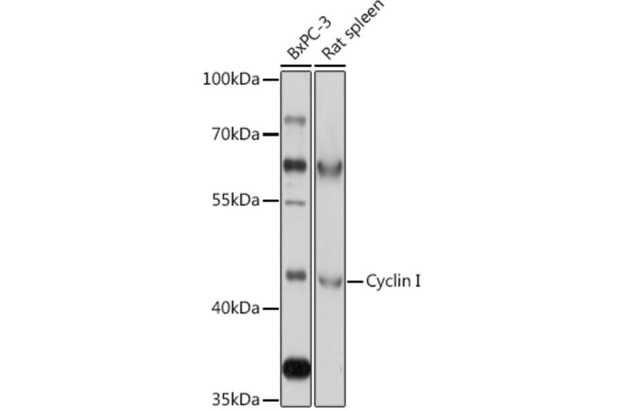 Western Blot - Anti-Cyclin Antibody (A308090) - Antibodies.com