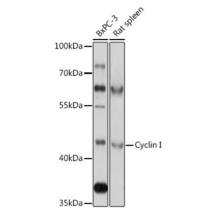 Western Blot - Anti-Cyclin Antibody (A308090) - Antibodies.com