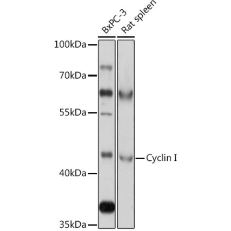 Western Blot - Anti-Cyclin Antibody (A308090) - Antibodies.com