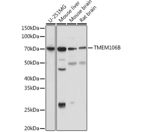 Western Blot - Anti-TMEM106B Antibody (A308091) - Antibodies.com