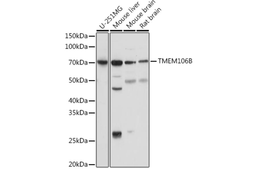 Western Blot - Anti-TMEM106B Antibody (A308091) - Antibodies.com