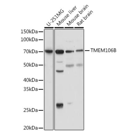 Western Blot - Anti-TMEM106B Antibody (A308091) - Antibodies.com