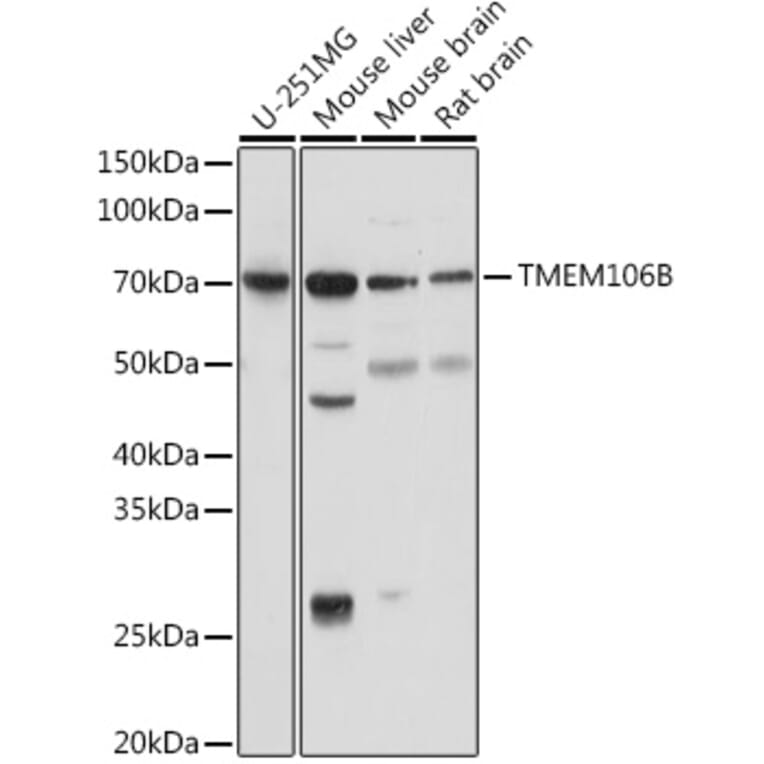 Western Blot - Anti-TMEM106B Antibody (A308091) - Antibodies.com