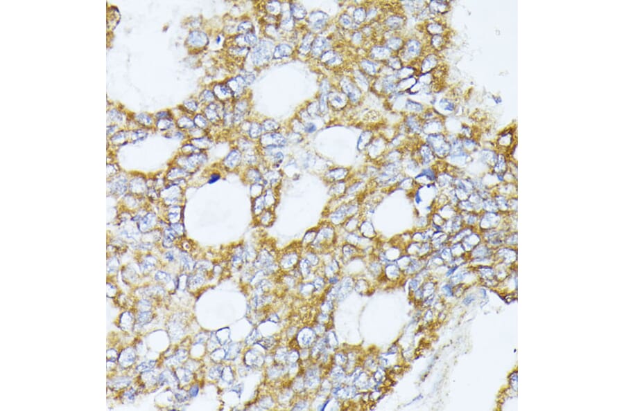 Immunohistochemistry - Anti-Complex IV Antibody (A308092) - Antibodies.com