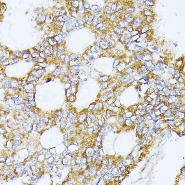Immunohistochemistry - Anti-Complex IV Antibody (A308092) - Antibodies.com