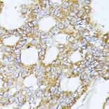 Immunohistochemistry - Anti-Complex IV Antibody (A308092) - Antibodies.com