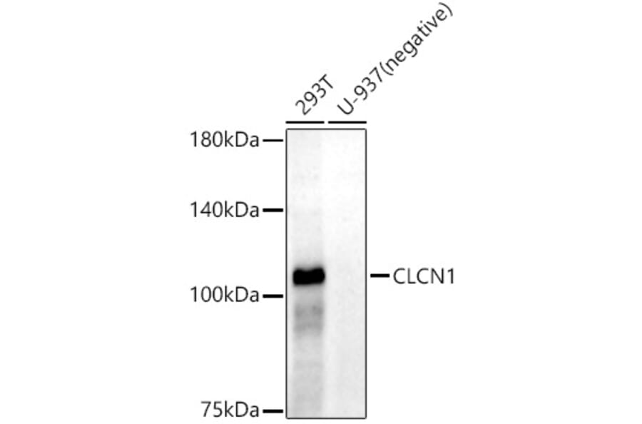 Western Blot - Anti-CLCN1 Antibody [ARC52491] (A308093) - Antibodies.com