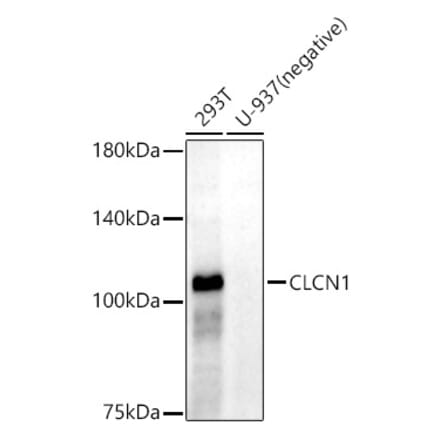 Western Blot - Anti-CLCN1 Antibody [ARC52491] (A308093) - Antibodies.com