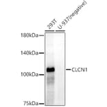 Western Blot - Anti-CLCN1 Antibody [ARC52491] (A308093) - Antibodies.com