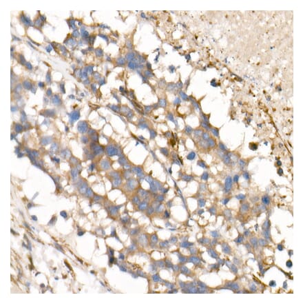 Immunohistochemistry - Anti-IL-15 Antibody [ARC53689] (A308095) - Antibodies.com