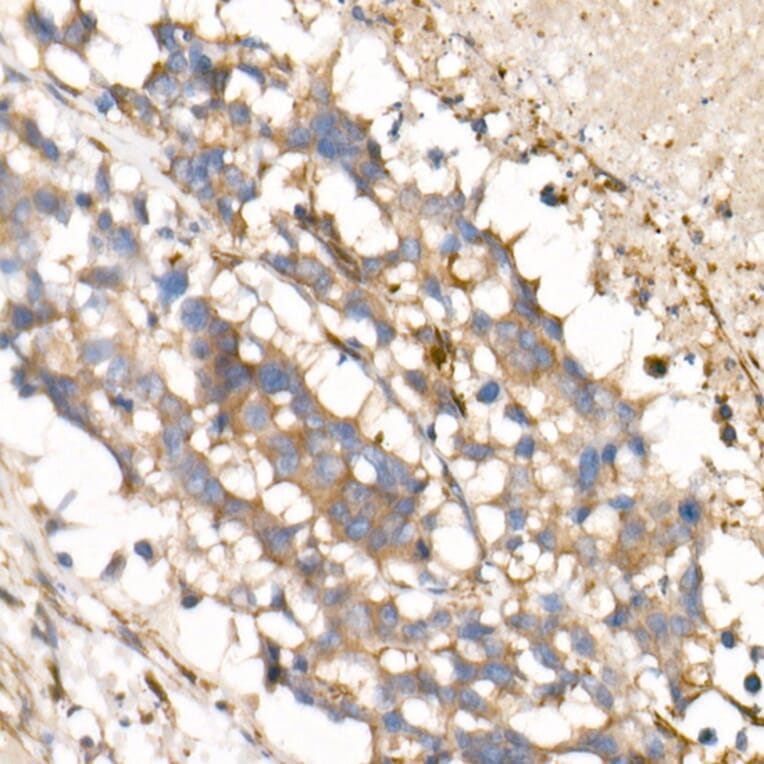 Immunohistochemistry - Anti-IL-15 Antibody [ARC53689] (A308095) - Antibodies.com