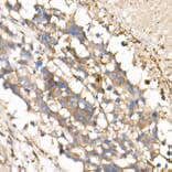 Immunohistochemistry - Anti-IL-15 Antibody [ARC53689] (A308095) - Antibodies.com