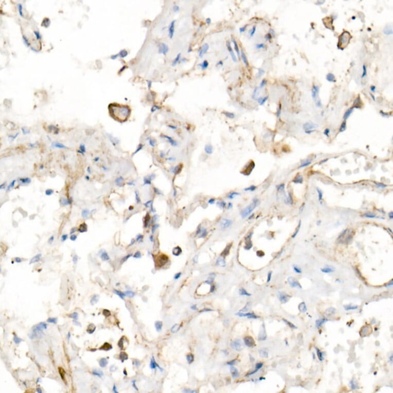 Immunohistochemistry - Anti-IL-15 Antibody [ARC53689] (A308095) - Antibodies.com