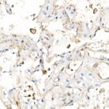 Immunohistochemistry - Anti-IL-15 Antibody [ARC53689] (A308095) - Antibodies.com