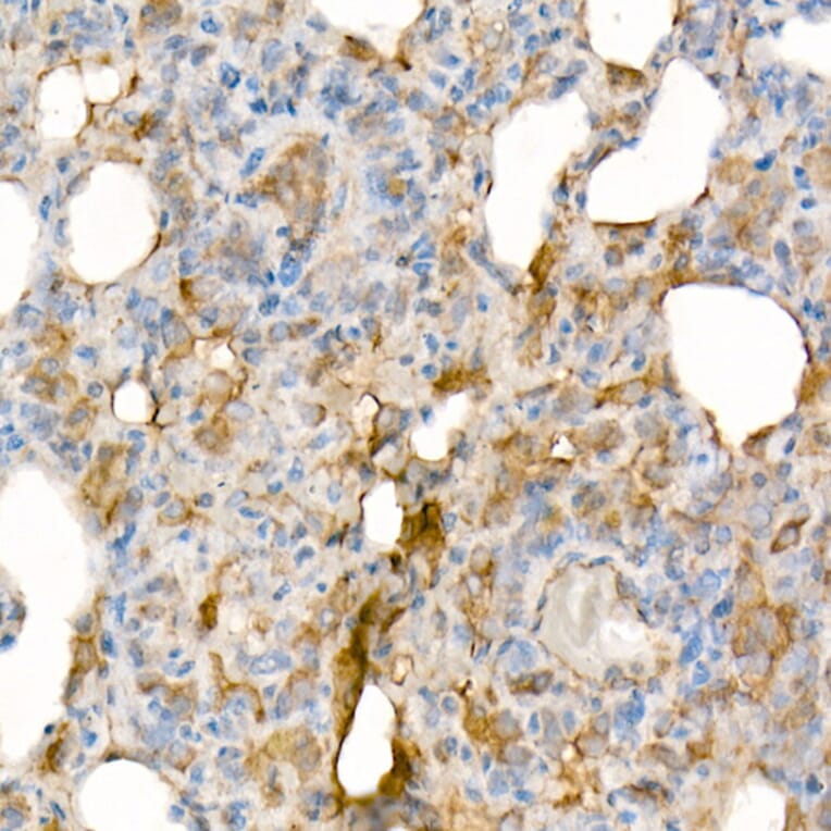 Immunohistochemistry - Anti-IL-15 Antibody [ARC53689] (A308095) - Antibodies.com