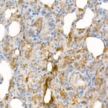 Immunohistochemistry - Anti-IL-15 Antibody [ARC53689] (A308095) - Antibodies.com