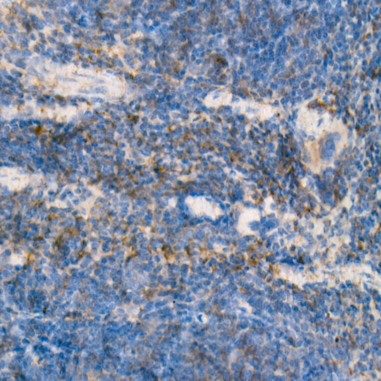 Immunohistochemistry - Anti-IL-15 Antibody [ARC53689] (A308095) - Antibodies.com