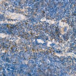 Immunohistochemistry - Anti-IL-15 Antibody [ARC53689] (A308095) - Antibodies.com