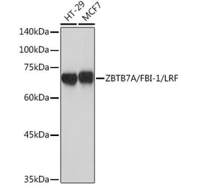 Western Blot - Anti-ZBTB7A Antibody [ARC2320] (A308096) - Antibodies.com