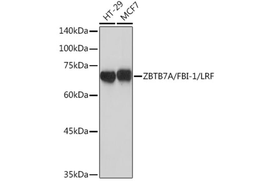 Western Blot - Anti-ZBTB7A Antibody [ARC2320] (A308096) - Antibodies.com