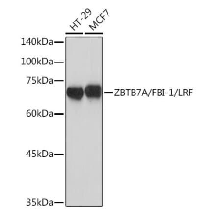Western Blot - Anti-ZBTB7A Antibody [ARC2320] (A308096) - Antibodies.com