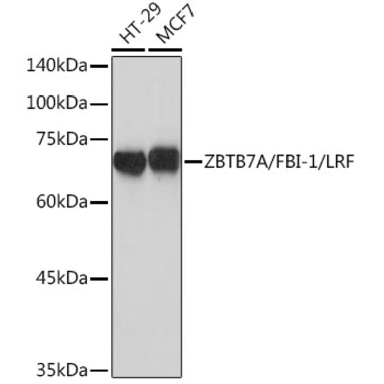 Western Blot - Anti-ZBTB7A Antibody [ARC2320] (A308096) - Antibodies.com