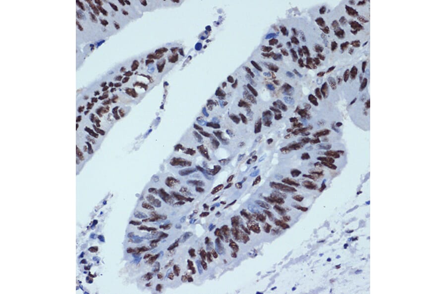 Immunohistochemistry - Anti-ZBTB7A Antibody [ARC2320] (A308096) - Antibodies.com