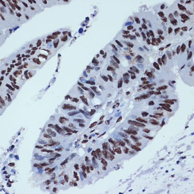 Immunohistochemistry - Anti-ZBTB7A Antibody [ARC2320] (A308096) - Antibodies.com