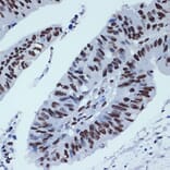 Immunohistochemistry - Anti-ZBTB7A Antibody [ARC2320] (A308096) - Antibodies.com