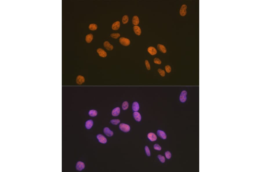 Immunofluorescence - Anti-ZBTB7A Antibody [ARC2320] (A308096) - Antibodies.com