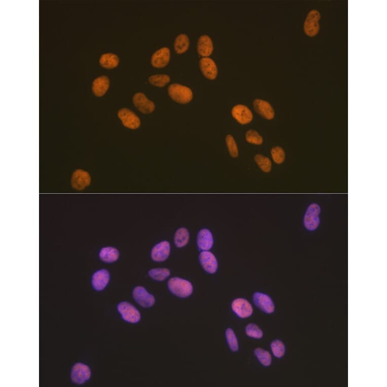 Immunofluorescence - Anti-ZBTB7A Antibody [ARC2320] (A308096) - Antibodies.com