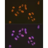 Immunofluorescence - Anti-ZBTB7A Antibody [ARC2320] (A308096) - Antibodies.com