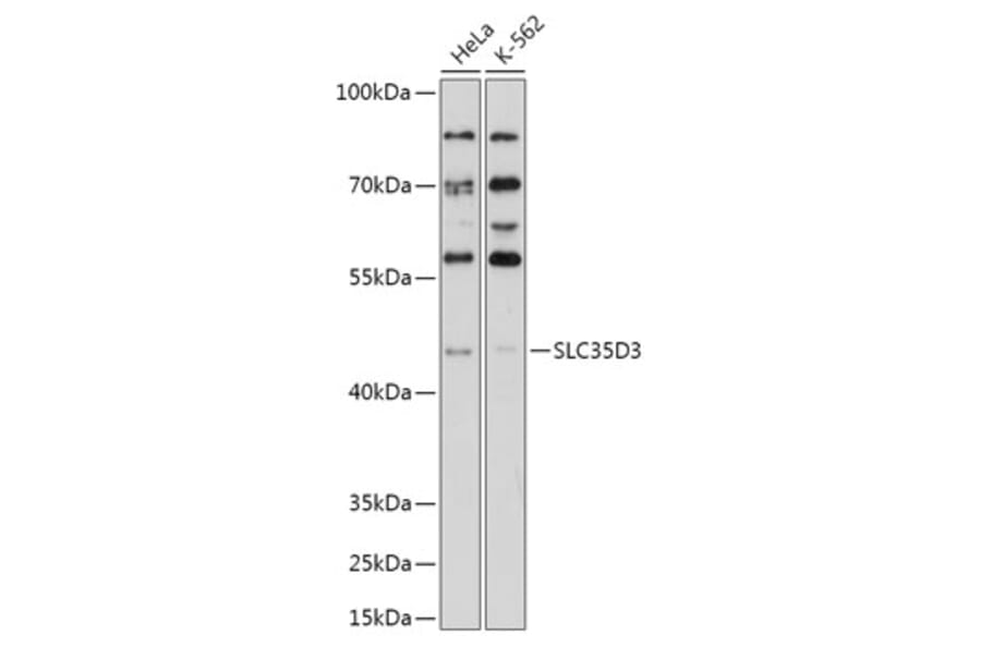 Western Blot - Anti-SLC35D3 Antibody (A308097) - Antibodies.com