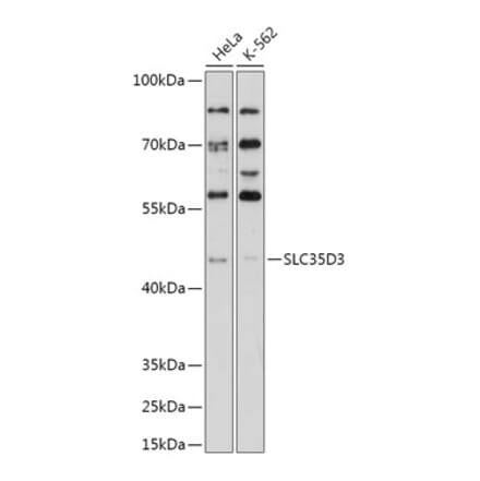 Western Blot - Anti-SLC35D3 Antibody (A308097) - Antibodies.com