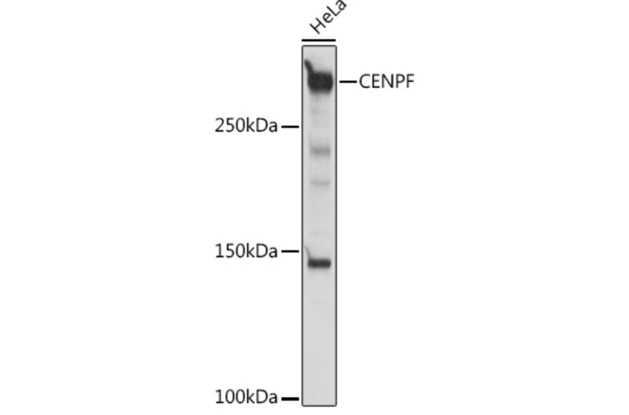 Western Blot - Anti-CENPF Antibody (A308098) - Antibodies.com
