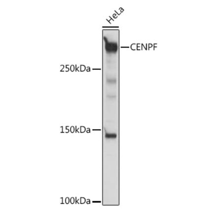 Western Blot - Anti-CENPF Antibody (A308098) - Antibodies.com