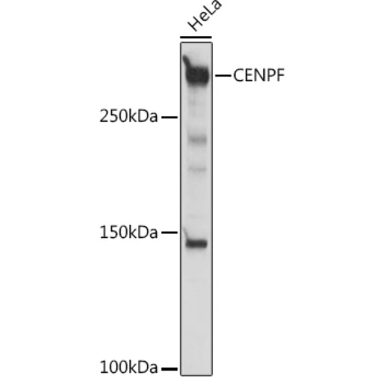 Western Blot - Anti-CENPF Antibody (A308098) - Antibodies.com